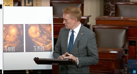 'Is That a Baby?': Sen. Lankford Takes Colleagues to School with Powerful 3D Ultrasound