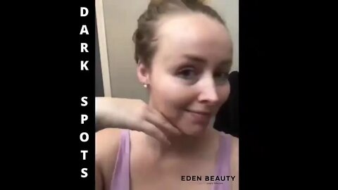 Extra Strength Dark Spot System Skincare Routine