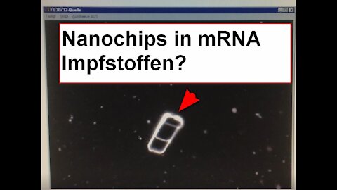 Nanochips in mRNA Impfstoffen?