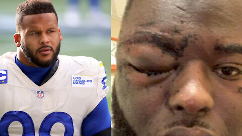 Aaron Donald Charged With Assault After Dude Says Donald JUMPED HIM After Accidental Bump