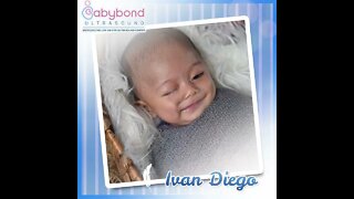 Baby Ivan Diego Before & After 😊♥️ Maraming salamat Babybond Ultrasound 👶 #themilags