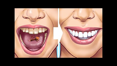 28 EASY TEETH HACKS THAT WORK MAGIC