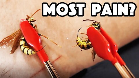 HORNET STING Vs WASP STING! Which hurt WORST?!