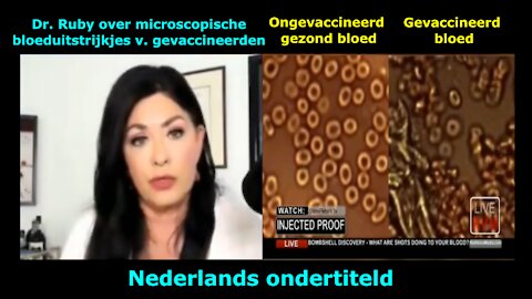 Dr. Jane Ruby over microscopische bloeduitstrijkjes van gevaccineerden - beschadigde bloedcellen!