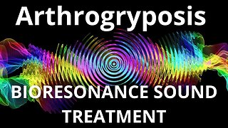 Arthrogryposis _ Sound therapy session _ Sounds of nature