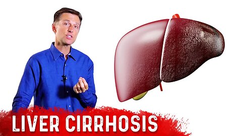 Is Liver Cirrhosis Reversible? - Fibrosis vs. Cirrhosis – Dr.Berg