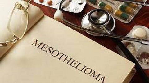 "Mesothelioma Attorney Assistant Part 2 - Expert Legal Guidance and Support"