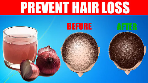 10 Proven Home Remedies For Hair Loss Prevention and Natural Regrowth | Hair Loss Treatment