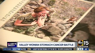 Valley woman shares battle after stomach cancer