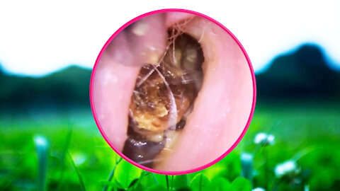 Ear Wax Removal With Clam Relaxing Music #02