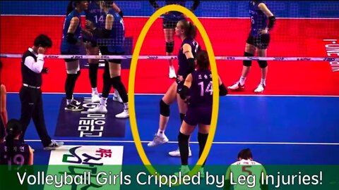 Volleyball Girls Crippled by Leg Injuries!
