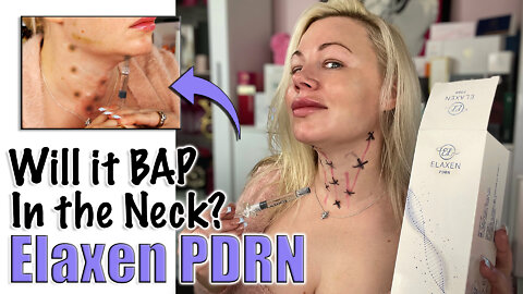 Elaxen PDRN, Will it BAP in the Neck? From Acecosm.com | Code Jessica10 Saves you Money!