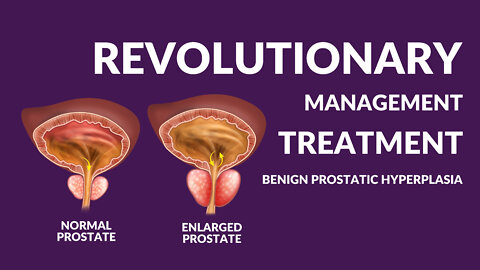 Benign Prostatic Hyperplasia- MANSMATTERS