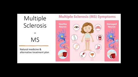 Multiple Sclerosis MS Natural treatment