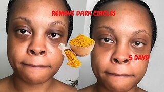 remove dark circles with tumeric in 5 days