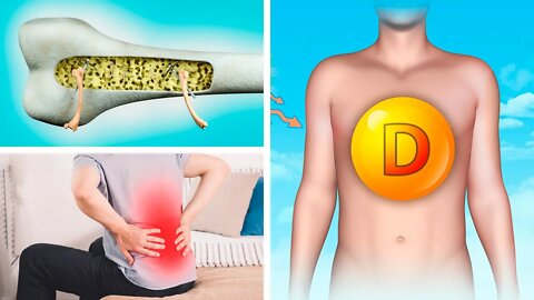 5 SINAIS DE DEFICIÊNCIA DE VITAMINA D - NÃO IGNORE