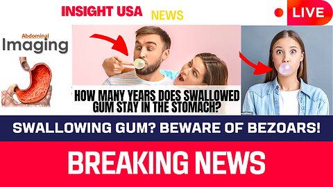Swallowing Gum? Beware of Bezoars!