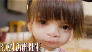 Doctors Can't Explain Our Rare Conditions | BORN DIFFERENT