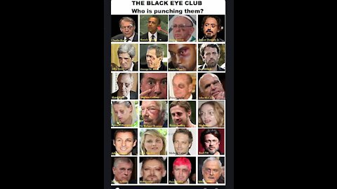 🔥🔥 What is the Black Eye Club? - Jessie Czebotar