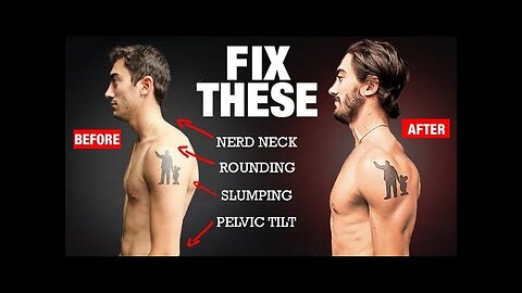 How to Fix Your Posture in 4 Moves! (PERMANENTLY)