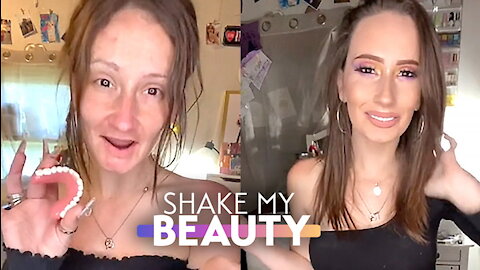 I'm Accused Of Catfishing Cos I Have No Teeth | SHAKE MY BEAUTY