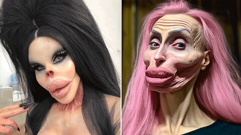 15 Times Plastic Surgery Ended in Disaster! 😱
