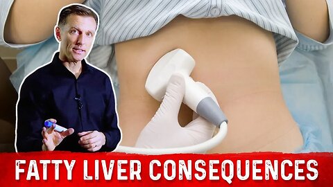 Consequences of a Fatty Liver that can Surprise You – Result of Fatty Liver Disease – Dr.Berg