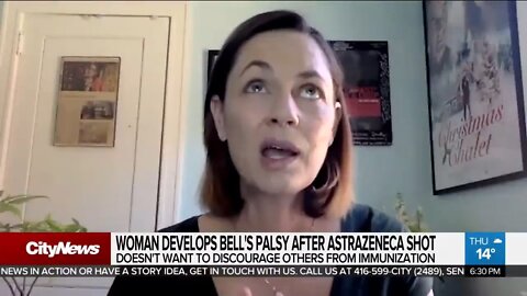 Jennifer Gibson Bell's Palsy Injury - August of 2021