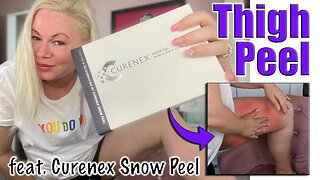 Peeling My Thighs with Curenex Snow Peel from Celestapro.com | Code Jessica10 saves you Money