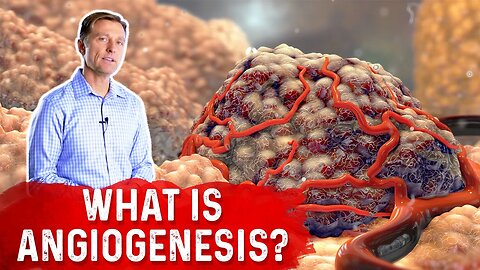 What is Angiogenesis? – Dr. Berg