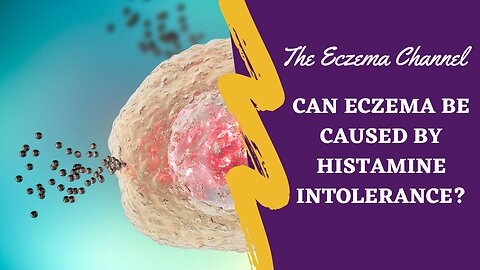 Can Eczema be Caused by Histamine Intolerance?