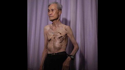 The Double Atomic Bomb Survivor: The Incredible Story of Tsutomu Yamaguchi #weirdhistory #survivor