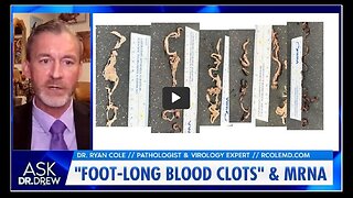 Dr. Drew Short: Dr Ryan Cole Intro into COVID Vaccine Blood Clots