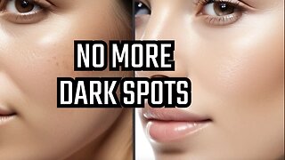 Get Rid Of Dark Spots With This No Downtime Chemical Peel