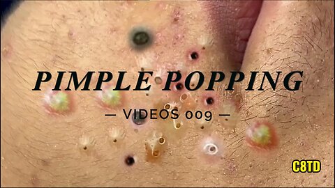 Satisfying Pimple Popping Videos 009