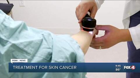 Your Healthy Family: Treatment options for skin cancer