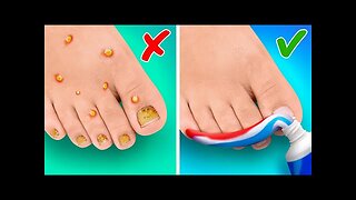 SMART FEET HACKS AND GADGETS TO MAKE YOUR LIFE EASIER || HD