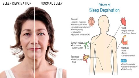 10 Scary Side Effects Of Sleep Deprivation