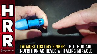 I almost LOST my finger... but GOD and NUTRITION achieved a healing MIRACLE