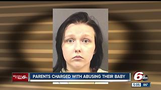 Infant found with multiple bone fractures; parents taken into police custody