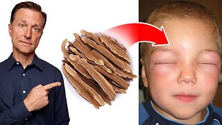 Natural Remedy for Anaphylactic Shock