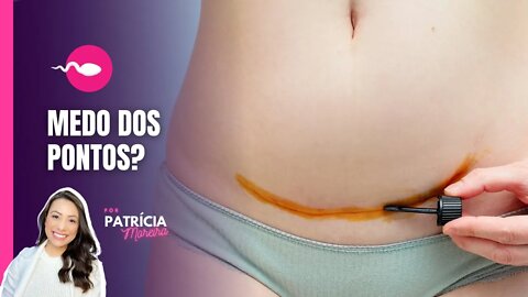 MEDOS DOS PONTOS NO PARTO? | Veja neste vídeo tudo sobre os pontos no parto normal e cesárea.