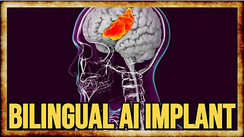 Stroke Survivor Communicates Bilingually With AI Brain Implant