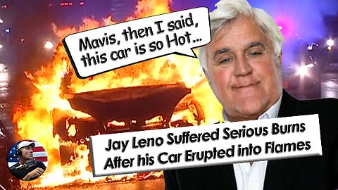 Jay Leno Suffers Serious Facial Burns After One of his Cars Explodes