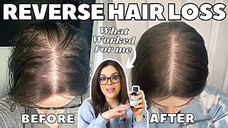 How I STOPPED MY HAIR LOSS! | #1 Thing That Re-Grew My Hair