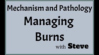 Managing Burns