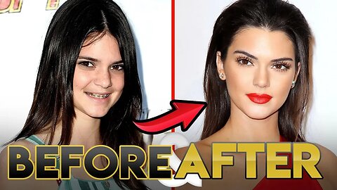 Kendall Jenner Glow Up 2019 | Before and After Transformations | KUWTK