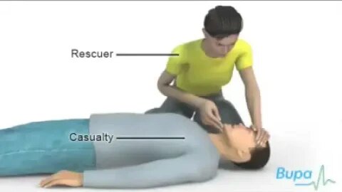 How to do cardiopulmonary resuscitation CPR