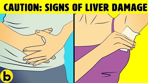 5 Liver Disease Symptoms That You Should Know