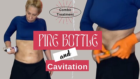 Pine Bottle Lipolysis & Cavitation for Fat Loss